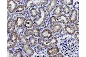 Expression of AQP1 in rat kidney - Immunohistochemical staining of paraffin-embedded rat kidney sections using Anti-Aquaporin 1 Antibody (ABIN7042932, ABIN7045194 and ABIN7045195), (1:100).