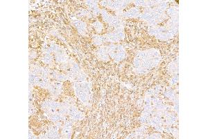 Immunohistochemistry (IHC) image for anti-ARHGDIB/D4-GDI/RhoGDI2 (AA 50-100) antibody (ABIN7453574) (ARHGDIB/D4-GDI/RhoGDI2 (AA 50-100) anticorps)