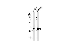 CASP3 Antibody (ABIN1882213 and ABIN2838477) western blot analysis in Jurkat,Ramos cell line lysates (35 μg/lane). (Caspase 3 anticorps)