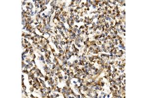 IHC analysis of TIMM29 using anti-TIMM29 antibody (ABIN7601495). (TIMM29 anticorps  (AA 37-260))