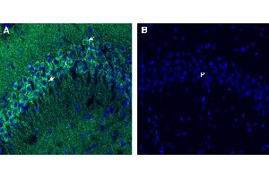 Free-floating frozen brain sections from a paraformaldehyde-perfused mouse were incubated with Anti-Endophilin-A1 antibody (ABIN7884928: 1:300), followed by goat anti-rabbit secondary antibody conjugated to Alexa Fluor® 488 (green). (SH3G2 anticorps  (Intracellular))