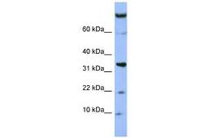 Image no. 1 for anti-Family with Sequence Similarity 178, Member B (FAM178B) (AA 607-656) antibody (ABIN6741667)