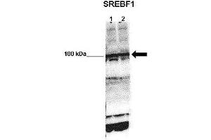 WB Suggested Anti-SREBF1 Antibody    Positive Control:  Lane 1: 50ug mouse glomerular endothelial lysate Lane 2: 50ug mouse glomerular endothelial lysate   Primary Antibody Dilution :   1:1000   Secondary Antibody :  Anti-rabbit-HRP   Secondry Antibody Dilution :   1:5000   Submitted by:  Xiaoxin Wang, UC Denver (SREBF1 anticorps  (N-Term))