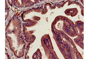 Immunohistochemistry of paraffin-embedded human prostate tissue using ABIN7149984 at dilution of 1:100