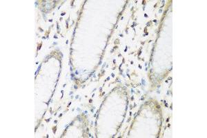 Immunohistochemistry of paraffin-embedded human stomach using EIF2B2 antibody at dilution of 1:200 (40x lens). (EIF2B2 anticorps)