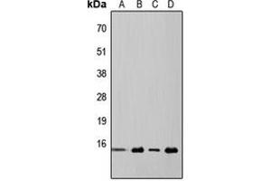 Western blot analysis of 4EBP1 expression in HeLa (A), MCF7 (B), mouse kidney (C), rat liver (D) whole cell lysates. (eIF4EBP1 anticorps  (Center))