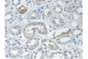 IHC-P analysis of Human Kidney Tissue, with DAB staining. (STAM2 anticorps  (AA 1-377))