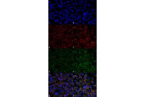 Immunocytochemistry/Immunofluorescence analysis using Mouse Anti-Hexanoyl-Lysine adduct Monoclonal Antibody, Clone 5E8 . (Hexanoyl-Lysine Adduct (HEL) anticorps (Atto 594))