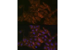 Immunofluorescence analysis of U2OS cells using KRAS+HRAS+NRAS Rabbit mAb (ABIN7267531) at dilution of 1:100 (40x lens).