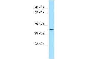 WB Suggested Anti-DUSP13 Antibody Titration: 1.