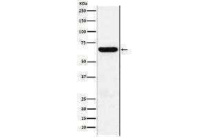 Western blot analysis of Methionine Aminopeptidase 2 expression in HeLa cell lysate.