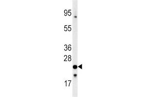 Western Blotting (WB) image for anti-Frataxin (FXN) antibody (ABIN3002642) (Frataxin anticorps)
