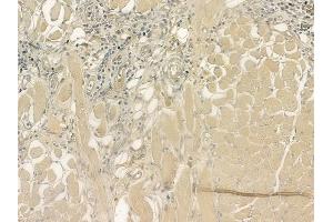 ABIN6264824 and ABIN6276917 at 1/100 staining human tongue carcinoma by IHC-P. (RPGR anticorps  (C-Term))
