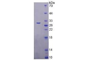SDS-PAGE analysis of Human TMEM173 Protein. (STING/TMEM173 Protéine)