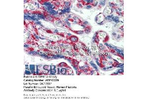 Immunohistochemistry (IHC) image for anti-G Protein-Coupled Receptor 6 (GPR6) (N-Term) antibody (ABIN2775307)
