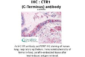 Image no. 2 for anti-Solute Carrier Family 31 (Copper Transporters), Member 1 (SLC31A1) (C-Term) antibody (ABIN1733362)