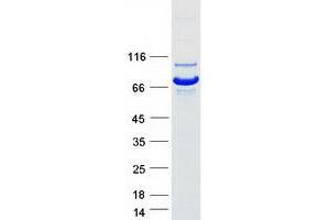 Validation with Western Blot
