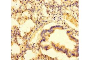 Immunohistochemistry of paraffin-embedded human lung tissue using ABIN7163391 at dilution of 1:100