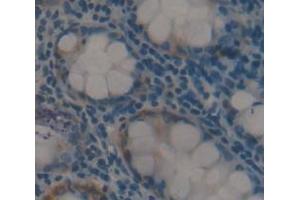 IHC-P analysis of Human Tissue, with DAB staining. (F4/80 anticorps  (AA 1-201))