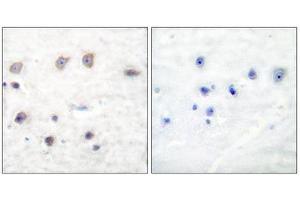 Immunohistochemistry (IHC) image for anti-Adducin 1 (Alpha) (ADD1) (pSer726) antibody (ABIN1847202)