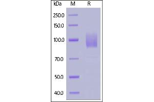 Human GUCY2C, Fc Tag on  under reducing (R) condition. (GUCY2C Protein (AA 24-430) (Fc Tag))
