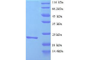 SDS-PAGE (SDS) image for Amiloride Binding Protein 1 (Amine Oxidase (Copper-Containing)) (ABP1) (AA 39-201) protein (His tag) (ABIN5712890)