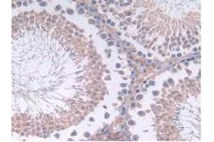 IHC-P analysis of Rat Testis Tissue, with DAB staining. (IL12A anticorps  (AA 23-215))