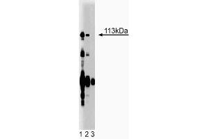 Western blot analysis of Itch on rat liver lysate. (ITCH anticorps  (AA 114-220))