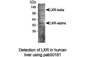 Image no. 1 for anti-Liver X Receptor (LXR) antibody (ABIN363490) (Liver X Receptor anticorps)