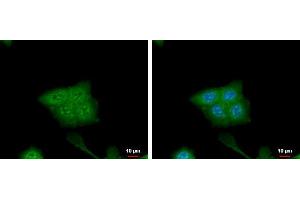 ICC/IF Image CRABP2 antibody [N1C3] detects CRABP2 protein at cytoplasm and nucleus by immunofluorescent analysis. (CRABP2 anticorps)