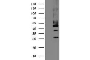 Western Blotting (WB) image for anti-Mannose Phosphate Isomerase (MPI) antibody (ABIN1499545)