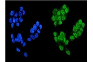 IF analysis of KDM5B using anti-KDM5B antibody (ABIN4886648). (KDM5B anticorps  (Middle Region))
