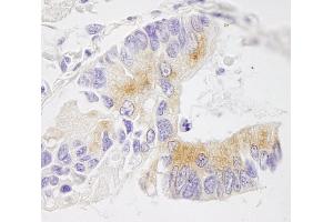 Immunohistochemistry (IHC) image for anti-Echinoderm Microtubule Associated Protein Like 4 (EML4) (AA 150-200) antibody (ABIN7448551) (EML4 anticorps  (AA 150-200))