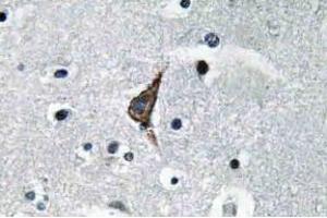 Immunohistochemistry (IHC) analyzes of TLR4 antibody in paraffin-embedded human brain tissue. (TLR4 anticorps)