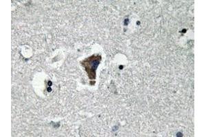 Immunohistochemistry analyzes of MyD88 antibody in paraffin-embedded human brain tissue. (MYD88 anticorps)
