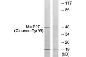 Western blot analysis of extracts from COS7 cells, treated with etoposide 25uM 1h, using MMP27 (Cleaved-Tyr99) Antibody. (MMP27 anticorps  (Cleaved-Tyr99))