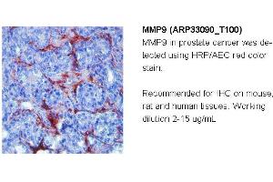 Image no. 2 for anti-Matrix Metallopeptidase 9 (Gelatinase B, 92kDa Gelatinase, 92kDa Type IV Collagenase) (MMP9) (N-Term) antibody (ABIN182741) (MMP 9 anticorps  (N-Term))