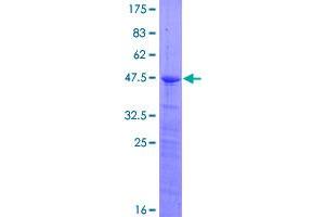 Image no. 1 for Ribosomal Protein S7 (RPS7) (AA 1-194) protein (GST tag) (ABIN1318851)