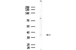 Western blot analysis of lysates from EC304 cells, using OR7C2 Antibody at 1/1000 dilution.