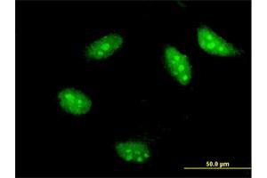 Immunofluorescence of monoclonal antibody to TWIST1 on HeLa cell. (TWIST1 anticorps  (AA 100-202))