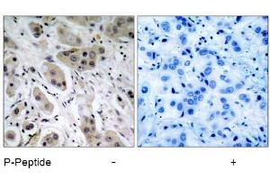 Image no. 1 for anti-V-Akt Murine Thymoma Viral Oncogene Homolog 1 (AKT1) (pSer473) antibody (ABIN196709) (AKT1 anticorps  (pSer473))