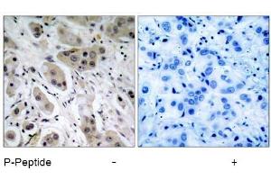 Image no. 1 for anti-V-Akt Murine Thymoma Viral Oncogene Homolog 1 (AKT1) (pSer473) antibody (ABIN196708) (AKT1 anticorps  (pSer473))