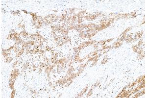 Immunohistochemistry (IHC) image for anti-Lectin, Galactoside-Binding, Soluble, 9 (LGALS9) (AA 305-355) antibody (ABIN7449427)