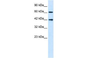 WB Suggested Anti-CFLAR Antibody Titration:  1. (FLIP anticorps  (N-Term))