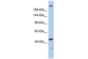 Image no. 1 for anti-Centrosomal Protein 170B (CEP170B) (AA 551-600) antibody (ABIN6743806) (KIAA0284 anticorps  (AA 551-600))