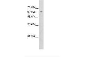 Image no. 2 for anti-Zinc Finger Protein 274 (ZNF274) (AA 87-136) antibody (ABIN203353) (ZNF274 anticorps  (AA 87-136))