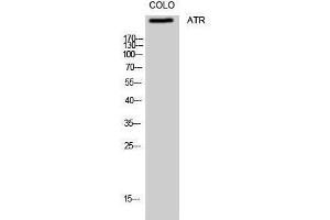 Western Blotting (WB) image for anti-ATR serine/threonine kinase (ATR) (Ser16) antibody (ABIN3183446)