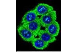 Confocal immunofluorescent analysis of PATL2 Antibody