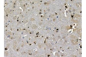 ABIN7095388 and ABIN7099445 at 1/100 staining rat brain tissue by IHC-P.