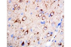 IHC-P: nNOS antibody testing of rat brain tissue (NOS1 anticorps  (C-Term))